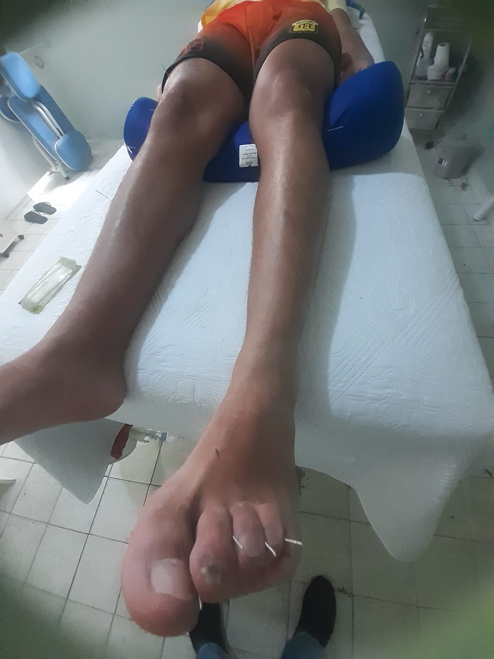 acupuntura1.jpg